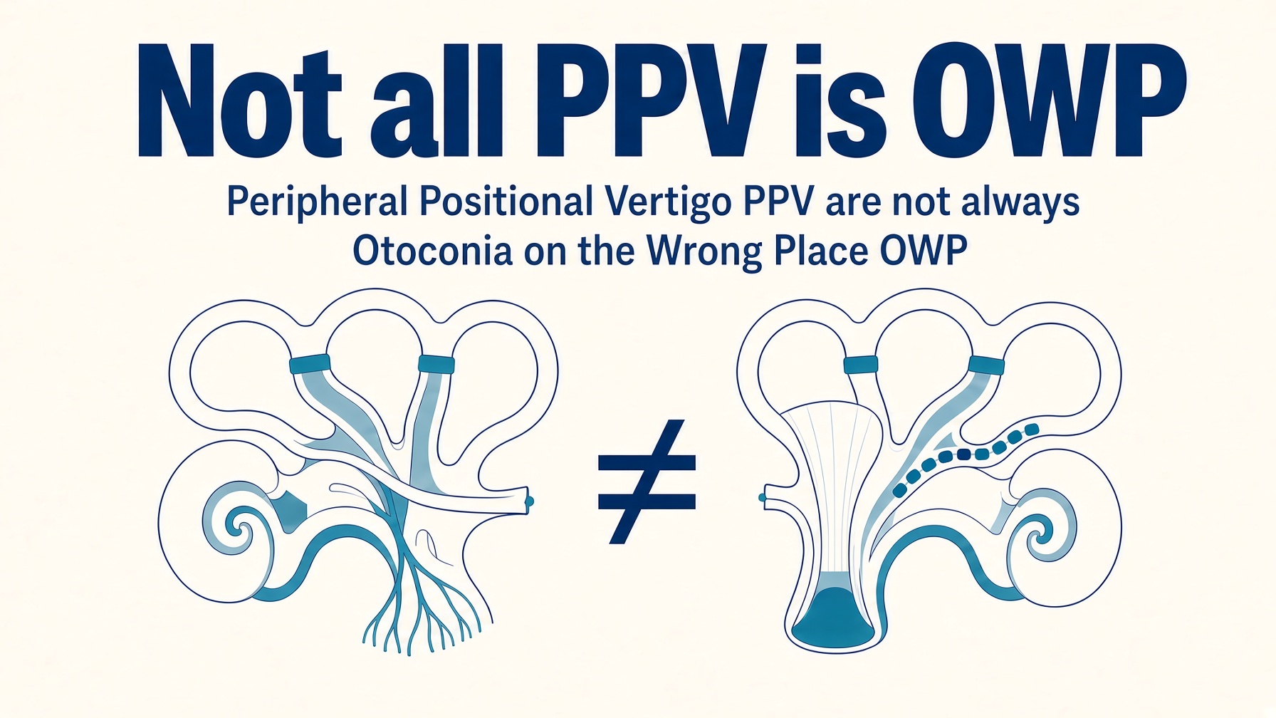 Not all PPV is OWP — peripheral positional vertigo is not always otoconia in the wrong place